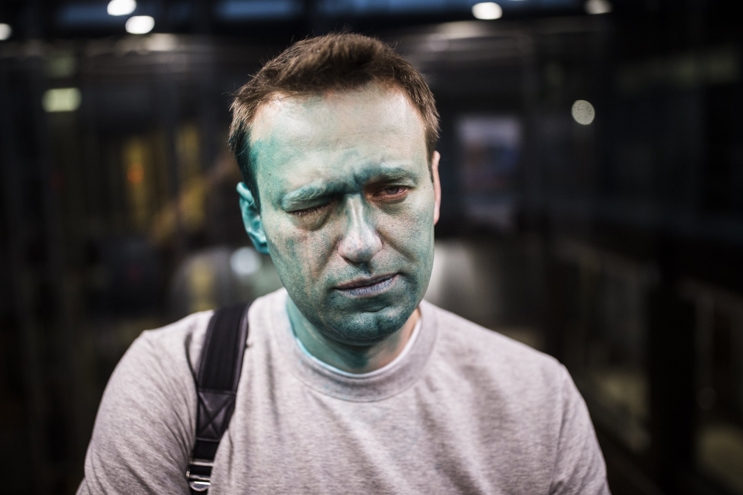 Навальному внезапно вернули загранпаспорт (его глаз потерял уже 85% зрения)
